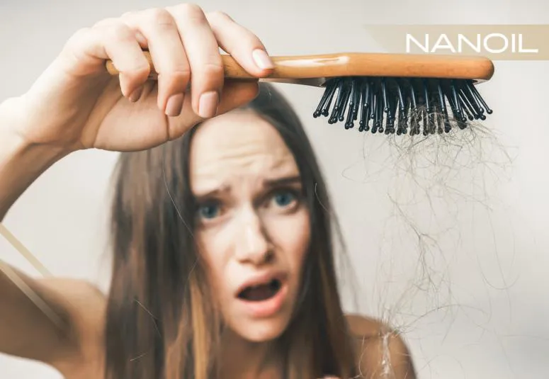 Cauzele căderii părului. Cum să creșteți volumul și să împiedicați părul să cadă?